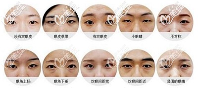 不同的眼睛类型需要采用不同的手术方式