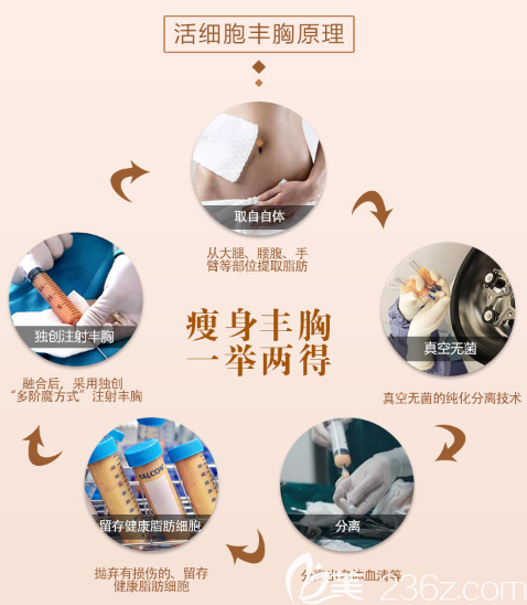 深圳润泽瑞尼丝自体脂肪丰胸过程图