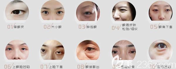 美杜莎6D魅眼术可以解决不同类型眼部问题